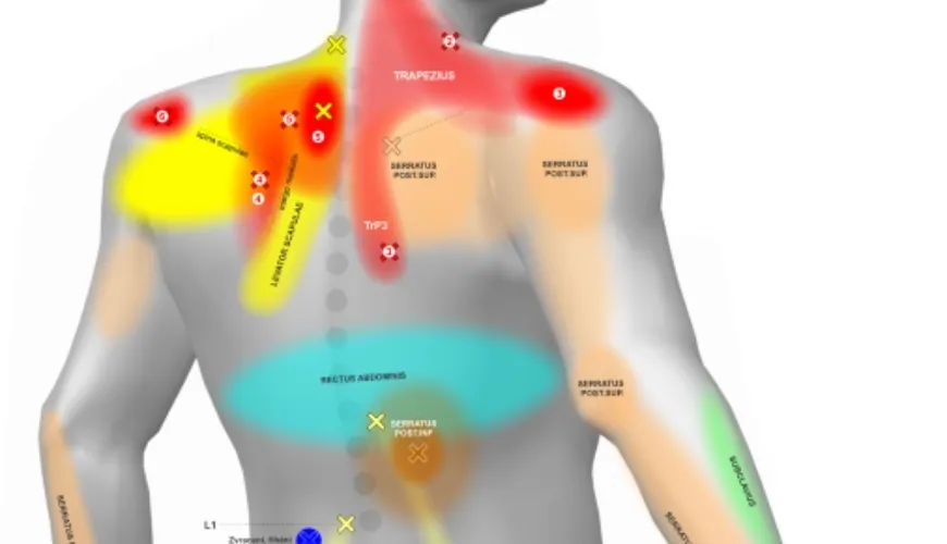 Jak pochopit a léčit bolesti zad díky body mapě